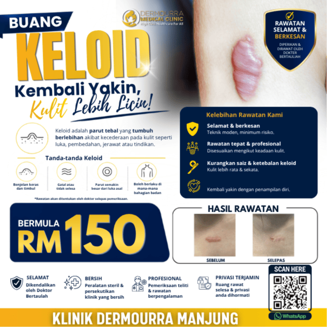 MINOR SURGERY - KELOID